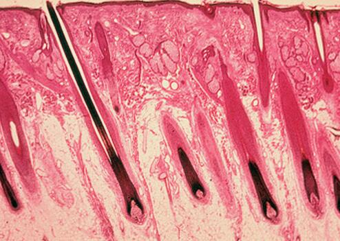 毛囊干细胞开发项目